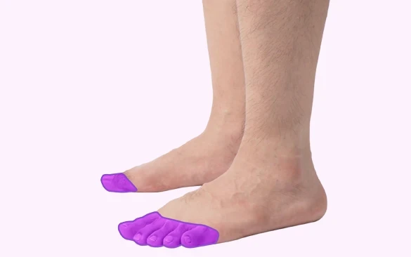 Пальцы ног - Лазерная эпиляция для мужчин Imperia-laser