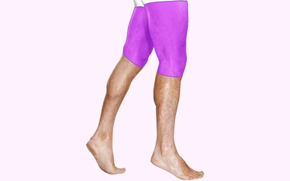 Бедра - Лазерная эпиляция для мужчин Imperia-laser