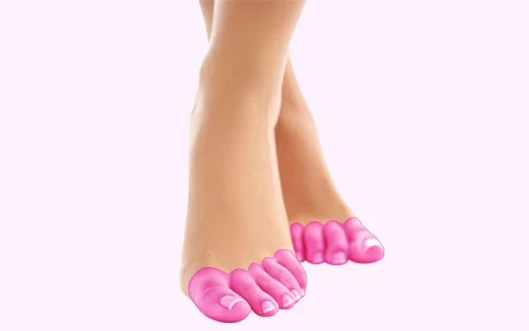 Пальці ніг - Лазерна епіляція Imperia-laser