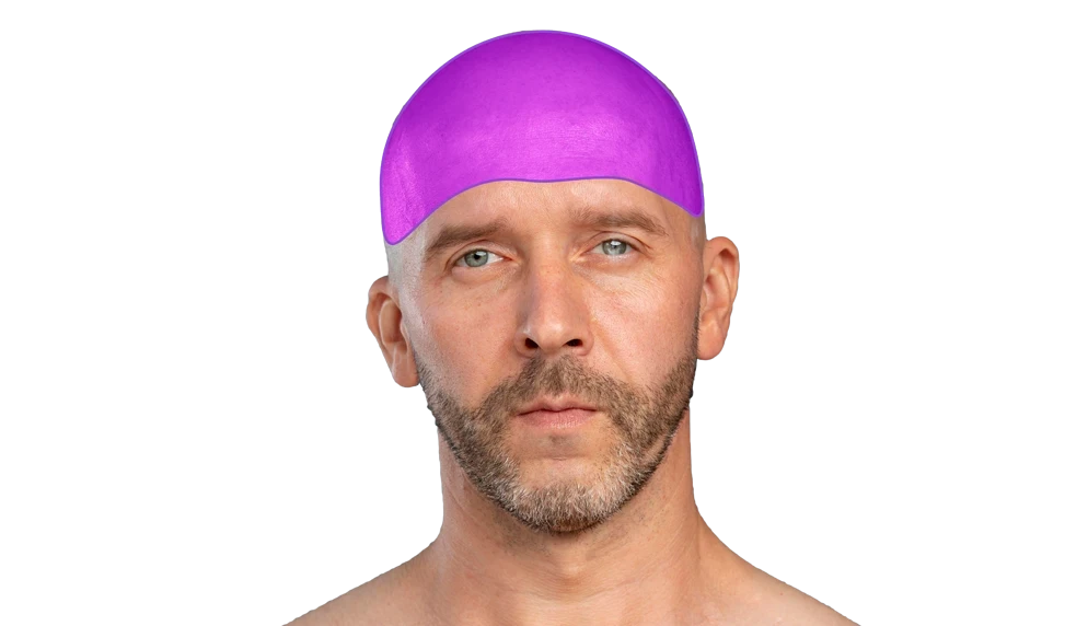 Лазерна епіляція голови для чоловіків