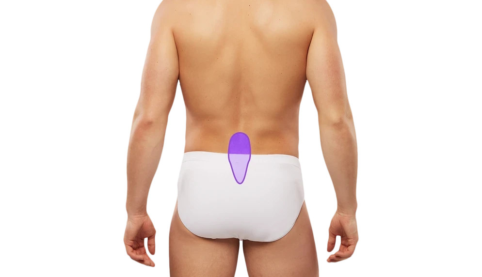 Лазерная эпиляция крестца для мужчин