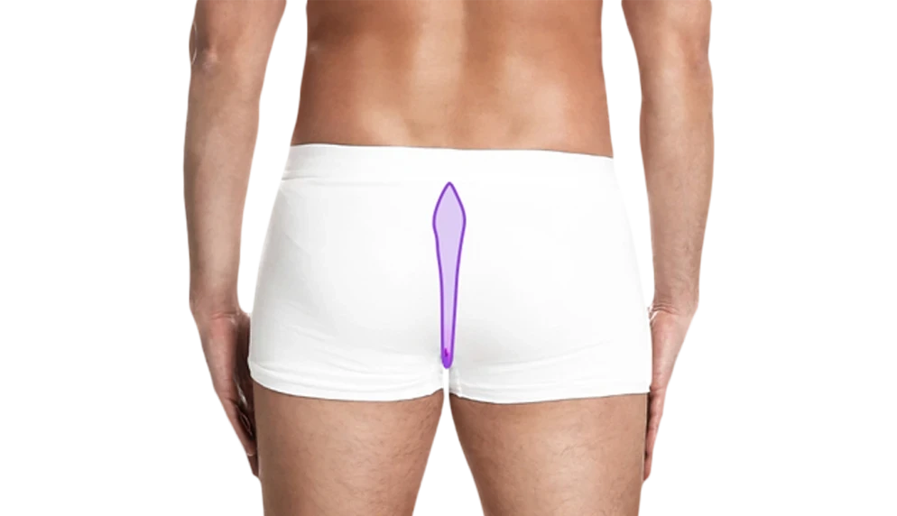 Лазерная эпиляция межъягодичной складки для мужчин