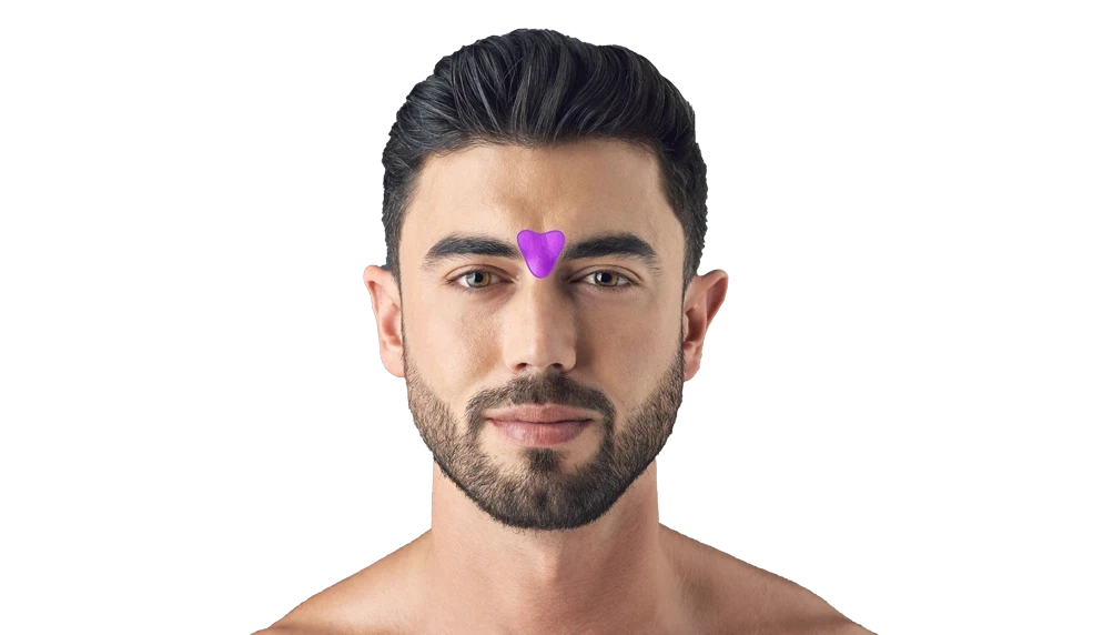 Лазерная эпиляция бровей у мужчин