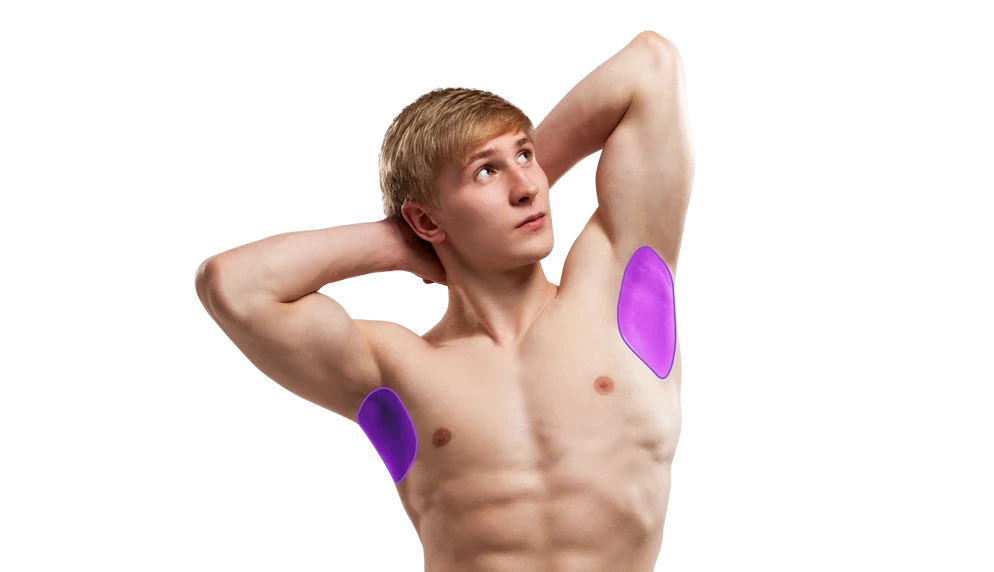 Лазерная эпиляция подмышек для мужчин