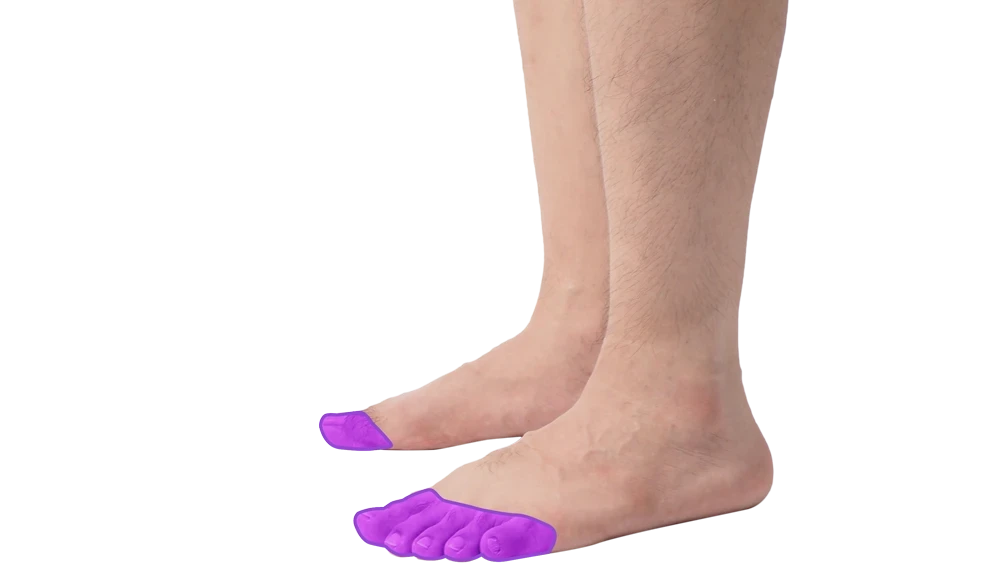 Лазерная эпиляция пальцев ног для мужчин