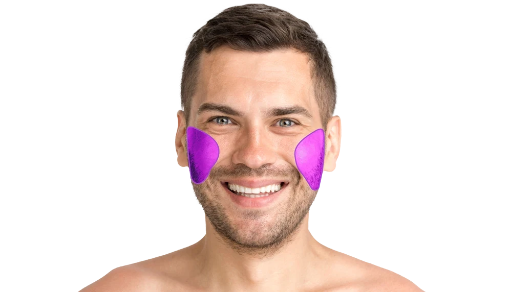 Лазерная эпиляция щек для мужчин