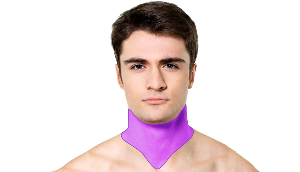 Лазерна епіляція шиї у чоловіків