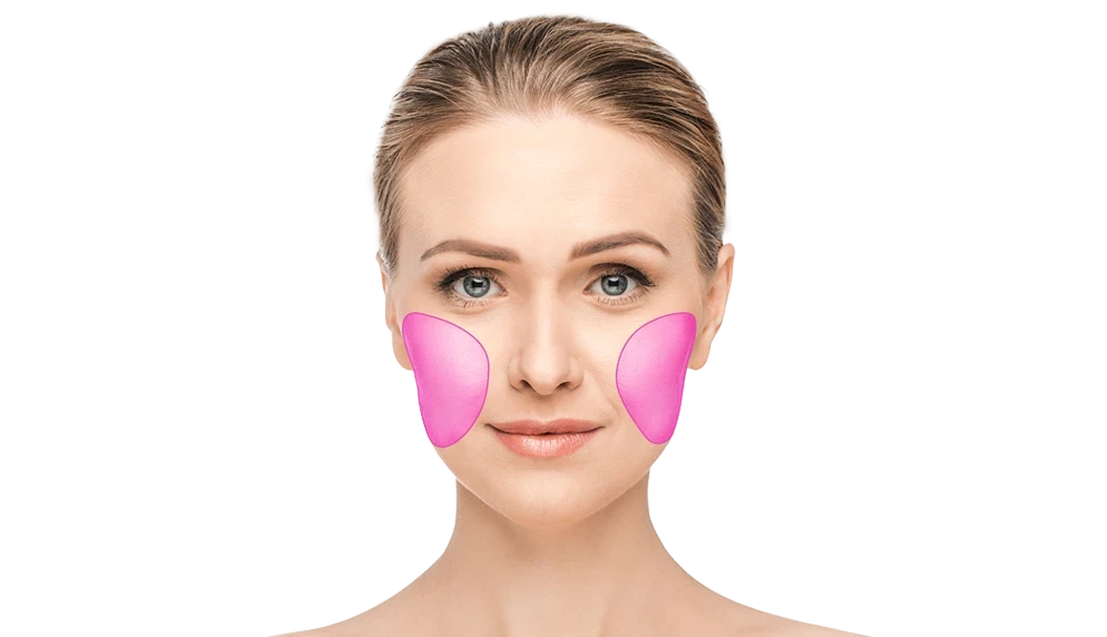 Лазерна епіляція щік