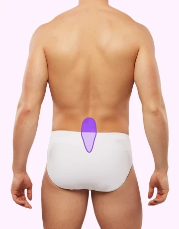 Лазерная эпиляция крестца для мужчин