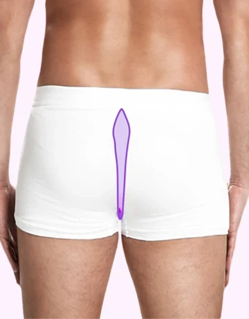 Лазерна епіляція міжягідної складки для чоловіків