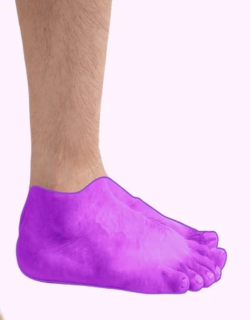 Лазерная эпиляция стоп для мужчин