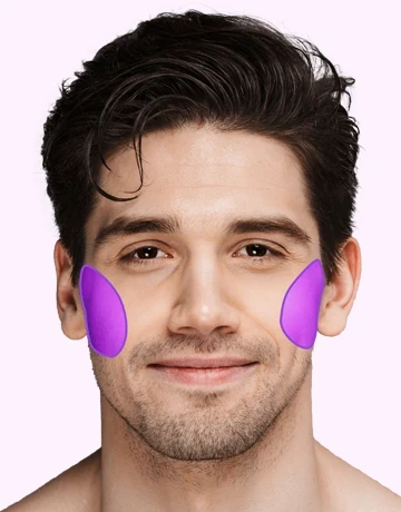 Лазерна епіляція вилиць для чоловіків