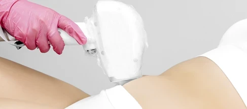 Що ми робимо? - фото imperia-laser